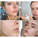 The Ordinary Niacinamide 10% + Zinc 1%, 30 ml