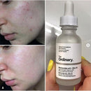 The Ordinary Niacinamide 10% + Zinc 1%, 30 ml