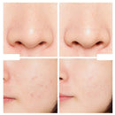 The Ordinary Peeling Aha 30% + Bha 2% -